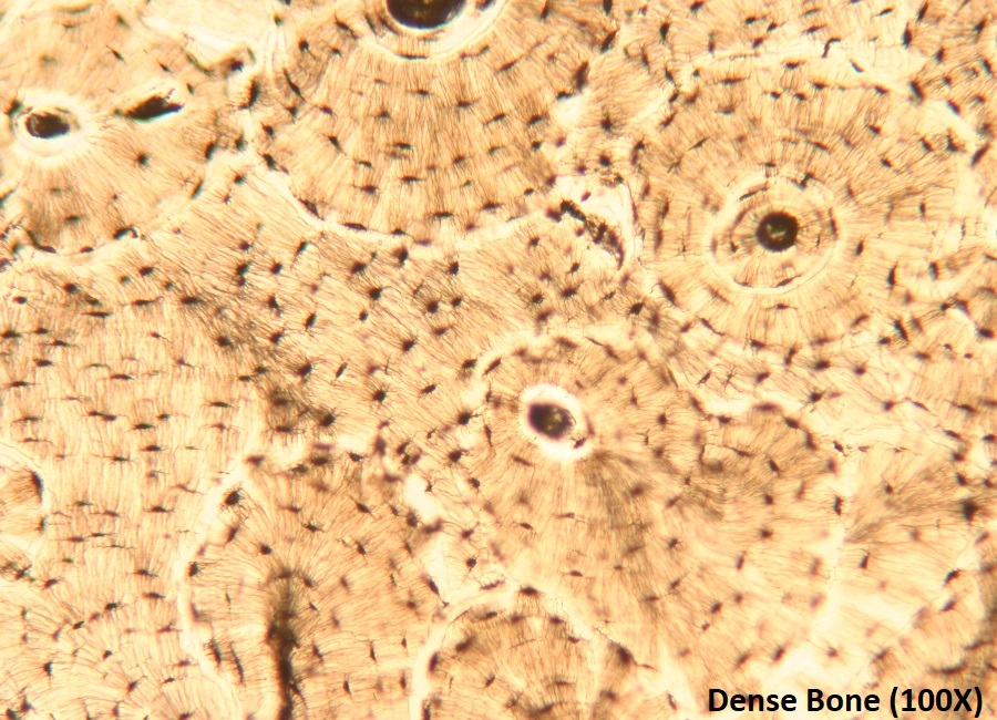 <p>Which connective tissue is this?</p>