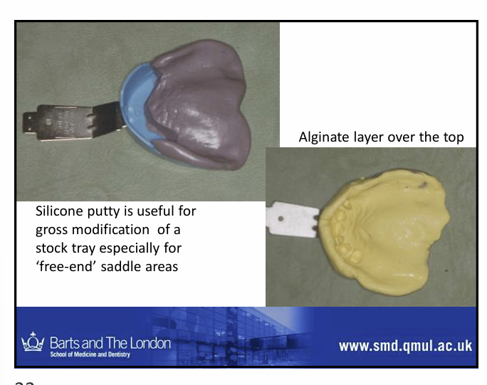 <p>Like in the card before, the patient only has natural teeth in the anterioir region so the posterior edentulous region has been blocked out by putty </p><p>alginate layer will then cover the top</p><p>improves the accuracy of the impression </p>