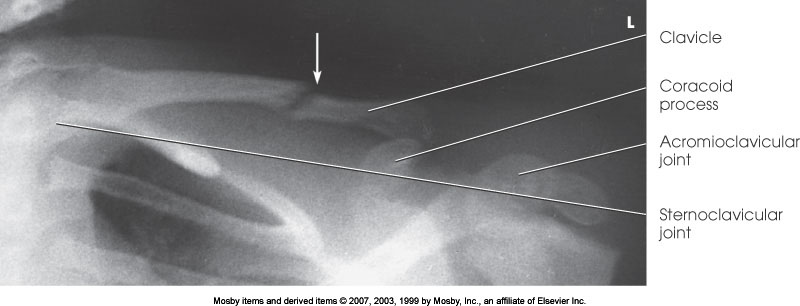 <p>What position is demonstrated?</p>