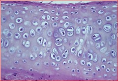 <h2><span class="heading-content">glassy or hazy , fibers do not stain clearly but cells do!</span></h2><p>• Functions = Supports and reinforces, resilient cushion, resists repetitive stress • Locations = Fetal skeleton, ends of long bones, costal cartilage of ribs, cartilages of nose, trachea, and larynx</p>