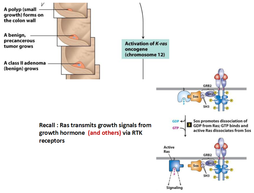 <p><strong>Polyp Formation</strong><br> A <strong>polyp</strong> (small growth) forms on the <strong>colon wall</strong><br> Develops into a <strong>benign, precancerous tumor</strong></p><p><strong>K-ras Oncogene Activation</strong><br> <strong>K-ras</strong> (<strong>chromosome 12</strong>) becomes <strong>activated</strong>, promoting growth of a <strong>class II adenoma (benign)</strong></p><p><strong>Ras Signaling Pathway</strong><br> <strong>Ras</strong> transmits <strong>growth signals</strong> from <strong>growth factors</strong> via <strong>RTK (receptor tyrosine kinase) receptors</strong><br> <strong>GRB2</strong> binds activated receptor<br> <strong>Sos</strong> promotes dissociation of <strong>GDP</strong> from <strong>Ras</strong><br> <strong>GTP</strong> binds <strong>Ras</strong>, activating it and allowing it to <strong>dissociate from Sos</strong></p><p><strong>Key Concept</strong><br> Activated <strong>Ras</strong> drives <strong>cell proliferation</strong>, contributing to tumor growth</p>