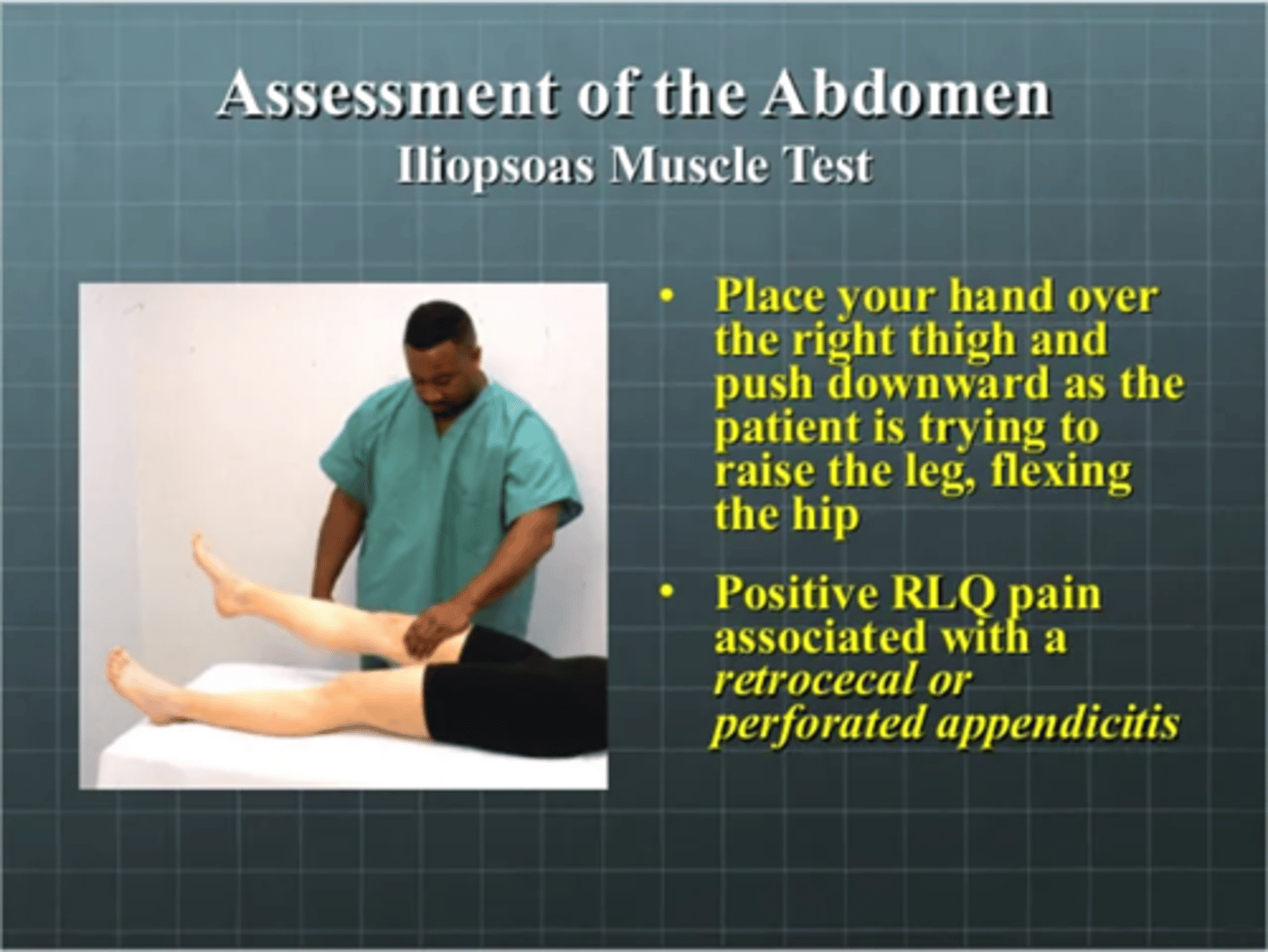 <p>a. place your hand over the right thigh and push downward as the patient is trying to raise the leg flexing the hip</p><p>b. positive RLQ pain associated with a retrocecal or perforated appendicitis</p>