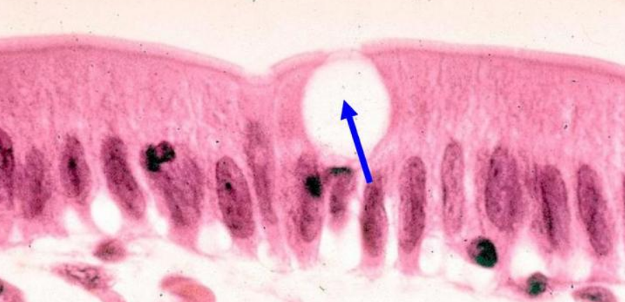 <p>What is the name of the cell the blue arrow is pointing at?</p>