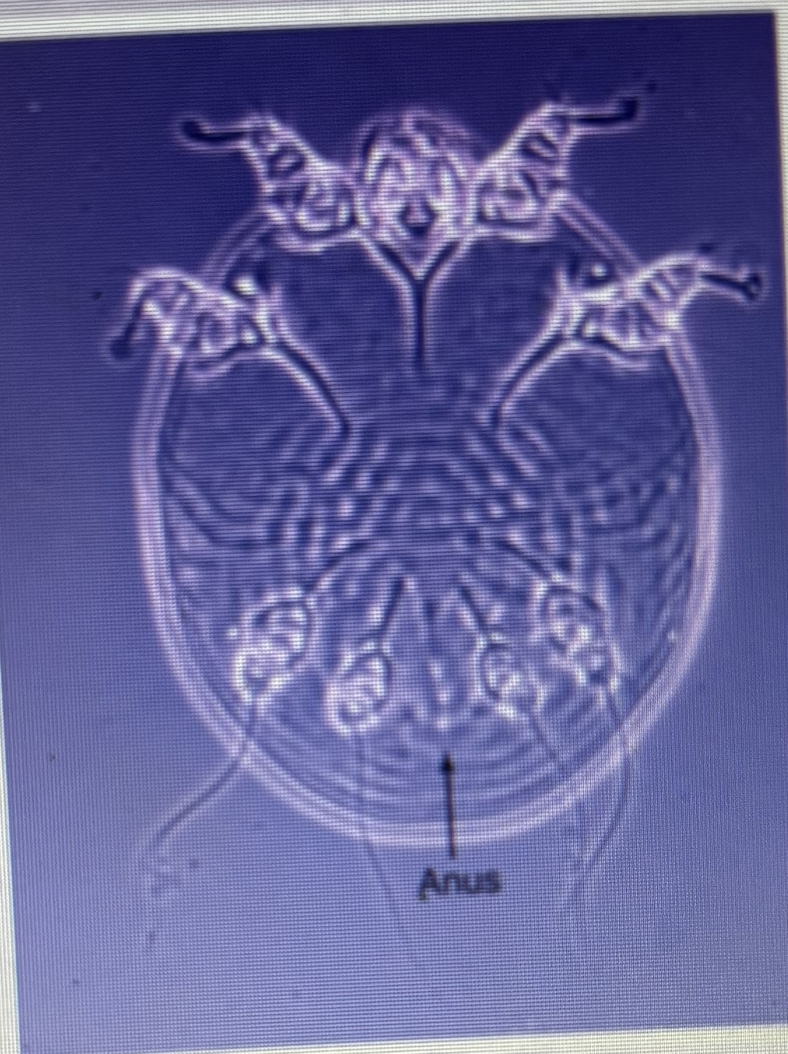 <p>Affects cats and rabbits</p><p>Highly contagious</p><p>Feline head mange</p><p>Dorsal anus</p>