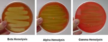 <ul><li><p>A toxin produced by some bacteria that causes the lysis of red blood cells, hemolysis</p></li><li><p>Test: Blood agar (Containing 5% sheep blood)</p></li></ul><p></p>