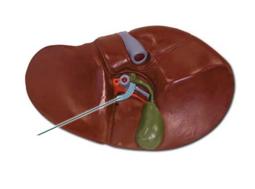 <p><span>Identify the highlighted liver lobe.</span></p>