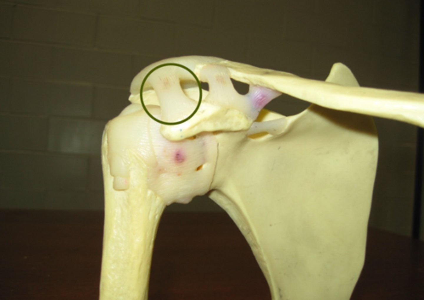 <p>Makes a connection between the coracoid process and the acromion</p>