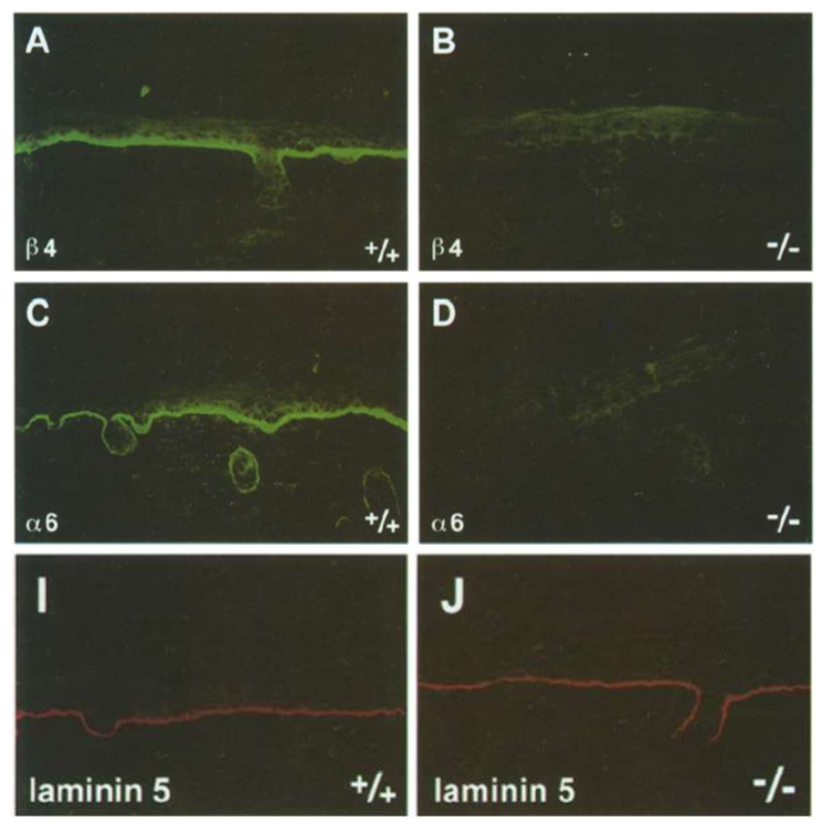 <ul><li><p>loss of alpha 6 integrin expression</p></li><li><p>formation of basement membrane still occurs, presence of laminin 5</p></li><li><p>able to make basement membrane, but unable to attach </p></li></ul><p></p>