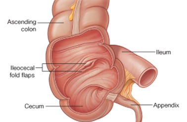 <p>when food reaches the end of the ileum, it enters the large intestine through the ileocecal valve</p><p>peristaltic contraction of terminal ileum forces chyme through the valve into the caecum</p><p>contraction of the caecum causes the ileocecal valve to close - prevents reflux of colonic contents into ileum</p><p>approx. 2L of material pass into caecum/day</p><p>at this point the chyme contains mostly water, indigestible food particles (fiber), and bile acids</p>