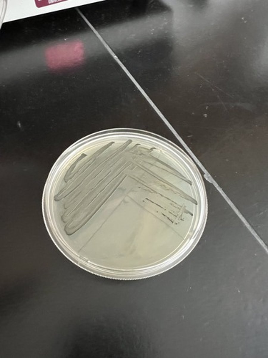 <p><strong>Differential </strong>for organisms ability to reduce Tellurite → Tellurium</p><p>Gram (+) sp. prefer this medium!</p>