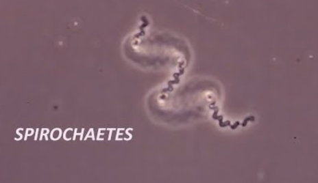 <p><span>Spirochetes are corkscrew-shaped bacteria that excel at moving in viscous medium (i.e. mud and mucus!)</span></p>