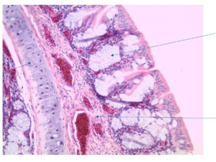 <p>What can we identify in this section and what is it a section of?</p>