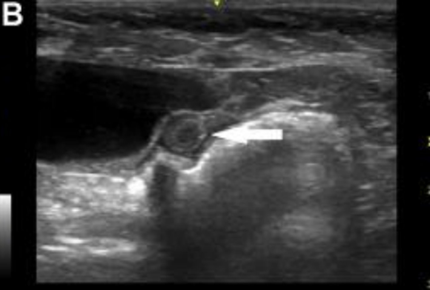 <p>What is the white arrow pointing to?</p>