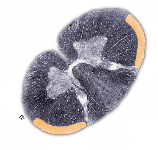 <p>dorsal spinocerebellar tract, tectospinal tract, spinothalamic pathway, or ventral spinocerebellar tract </p>