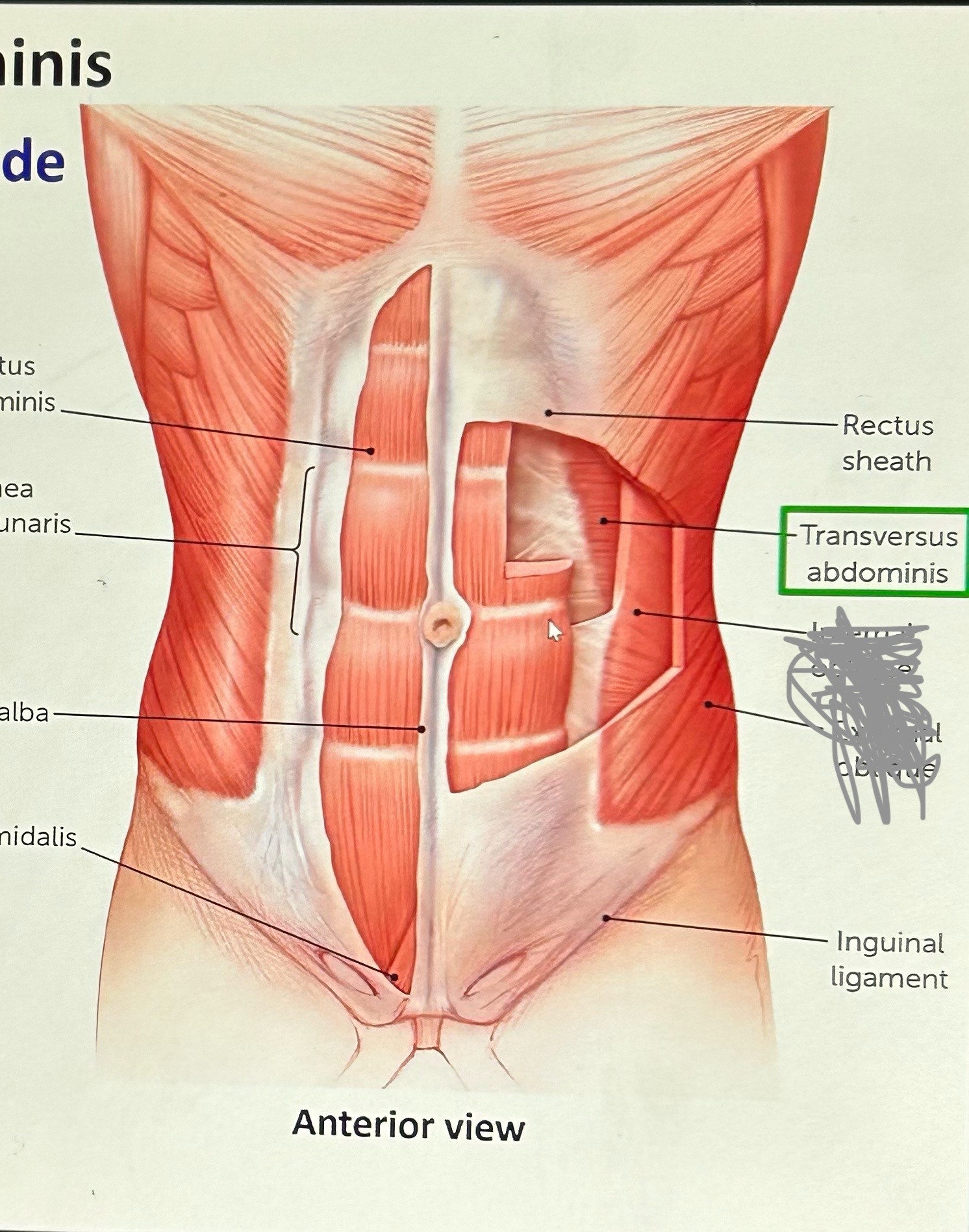 term image