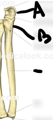 <p>what bone is this</p>