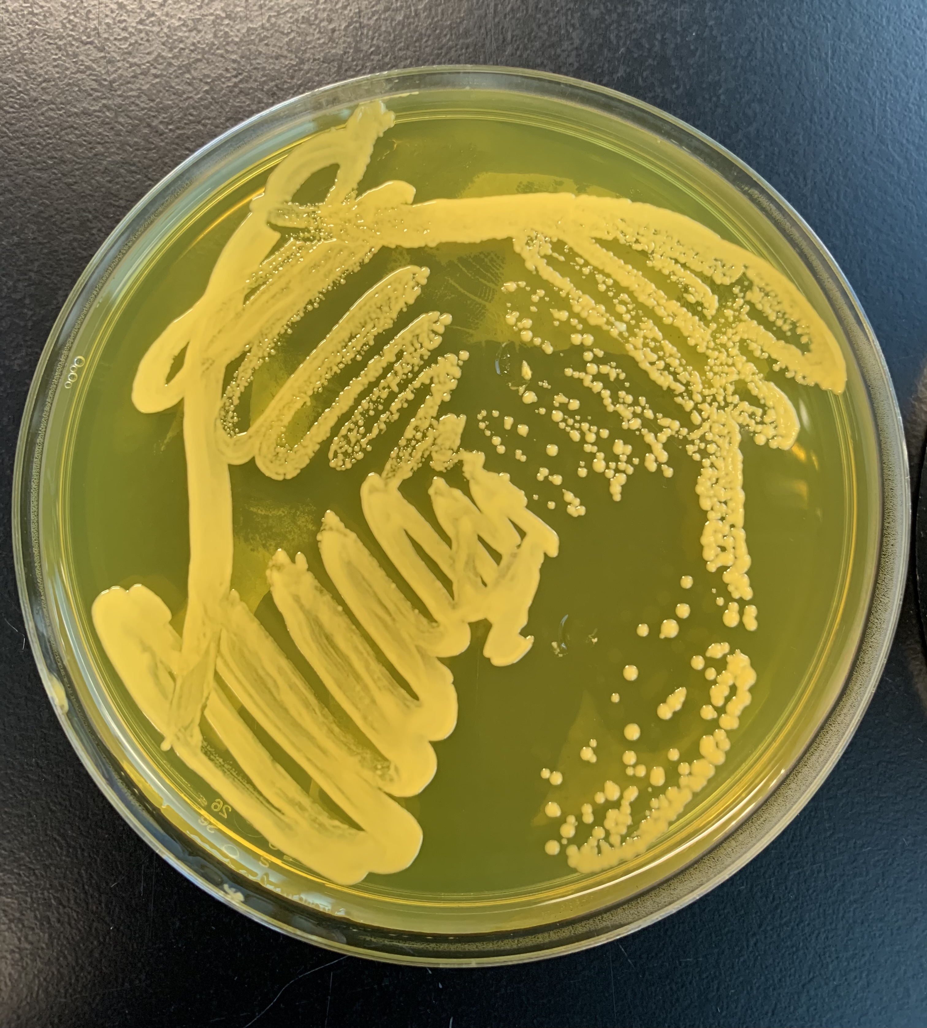 <p>What does a positive test of the MSA Salt Agar test indicate? </p>