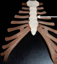 the breastbone, forms the middle of the front of the rib cage and is divided into three parts
