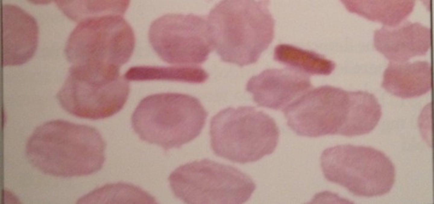 <p>análisis de sangre</p>