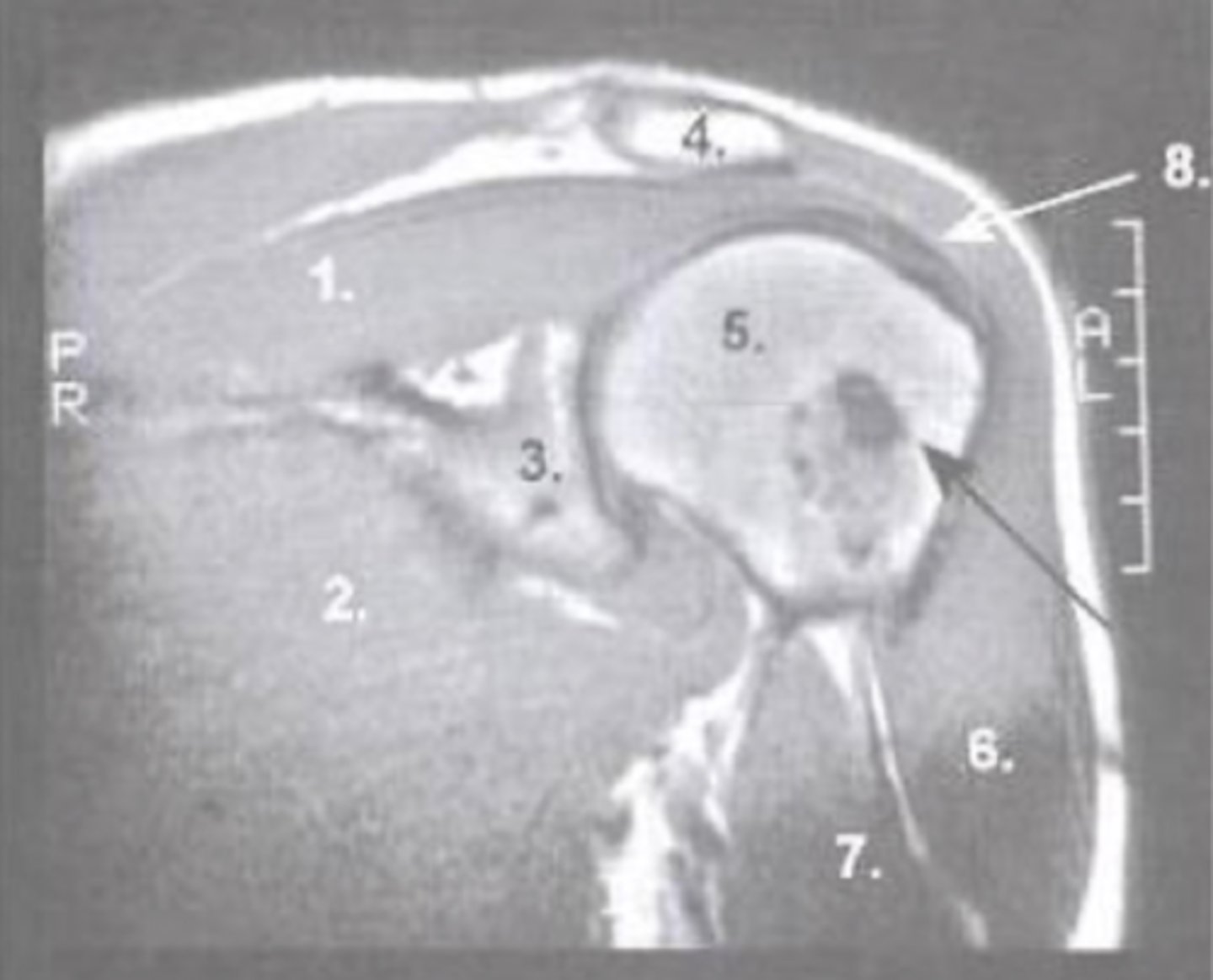 <p>What is number 2?</p>