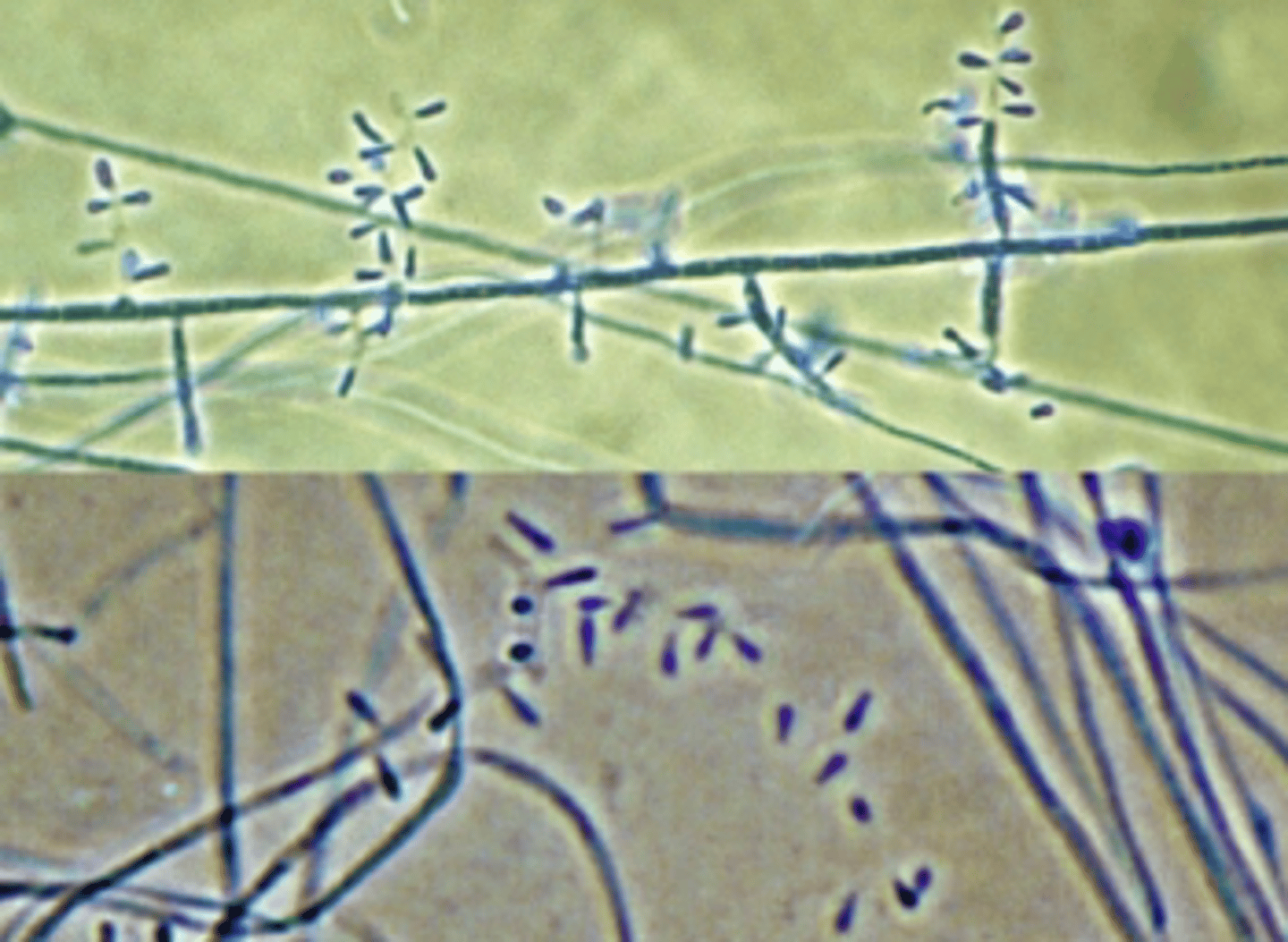 <p>Skin and nail infections</p><p>(most common worldwide)</p><p>• Colony surface is</p><p>white/buff</p><p>• Colony bottom is red</p><p>(rubrum)</p><p>• Tear shaped microconidia</p><p>"birds on a wire"</p><p>• Negative for hair shaft</p><p>penetration</p>