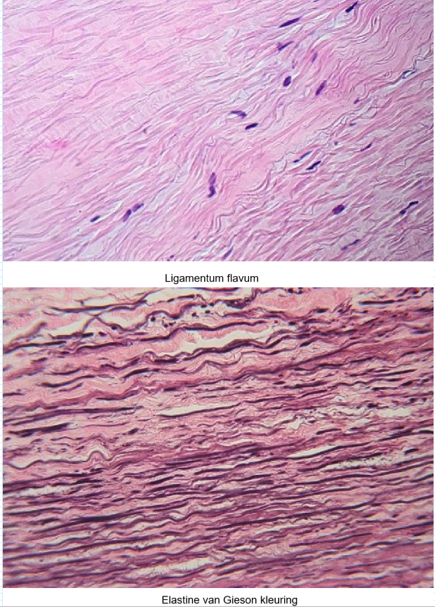 <p><strong>elastisch bindweefsel</strong></p>