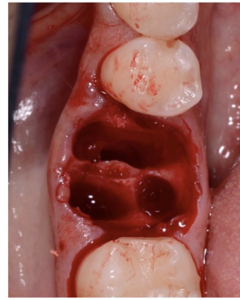 <p>Holds the tooth in the mouth</p>