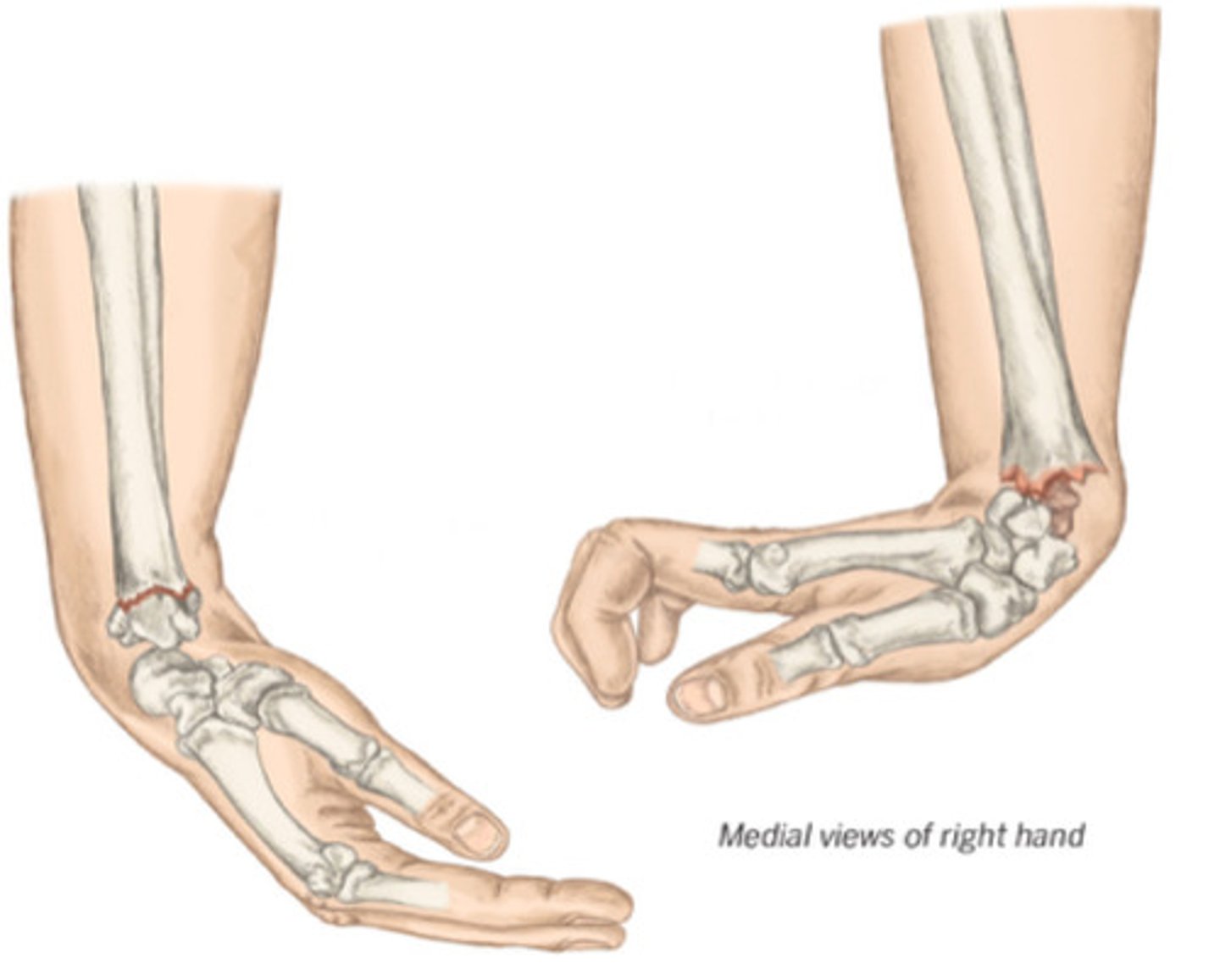 <p>Identify both of the pathologies</p>