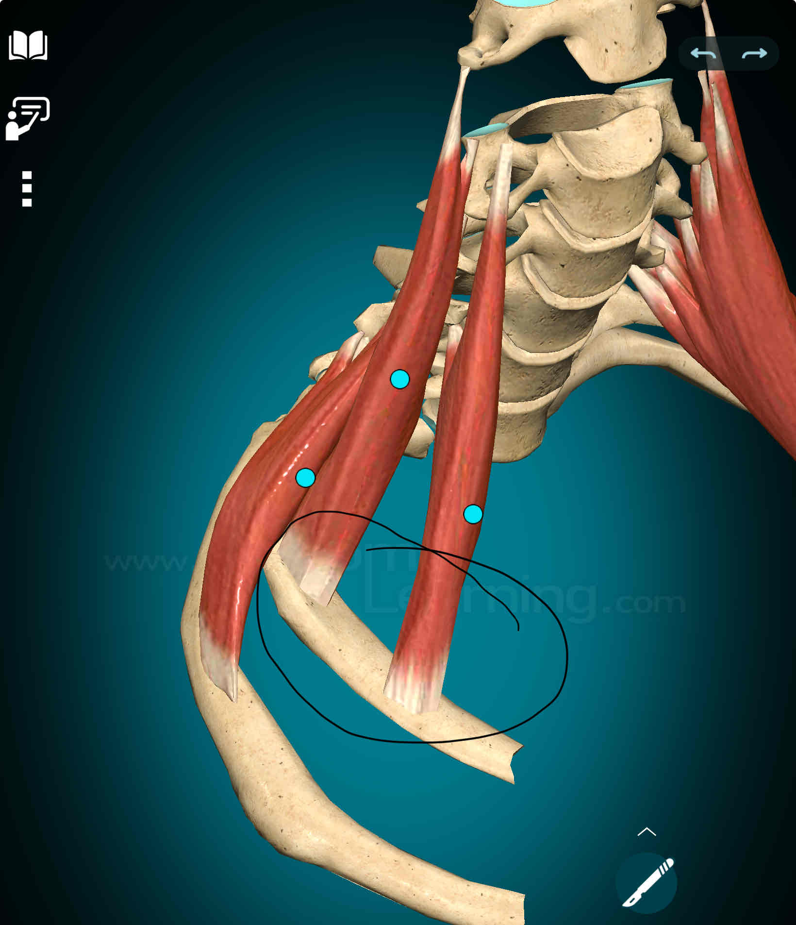 <p>Anterior Scalene Insertion</p>