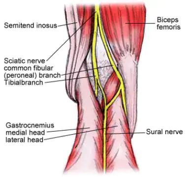 <p>Common peroneal</p>