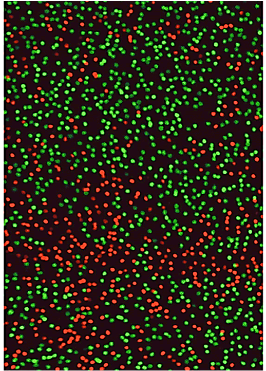 <p>Photoreceptors in the retina show patterns of X-chromosome inactivation. </p><p>Can use lineage tracing with GFP-reporter on Xm (green) and RPF reporter on Xp to see the female mosaic (two different X chromosomes in females). </p>