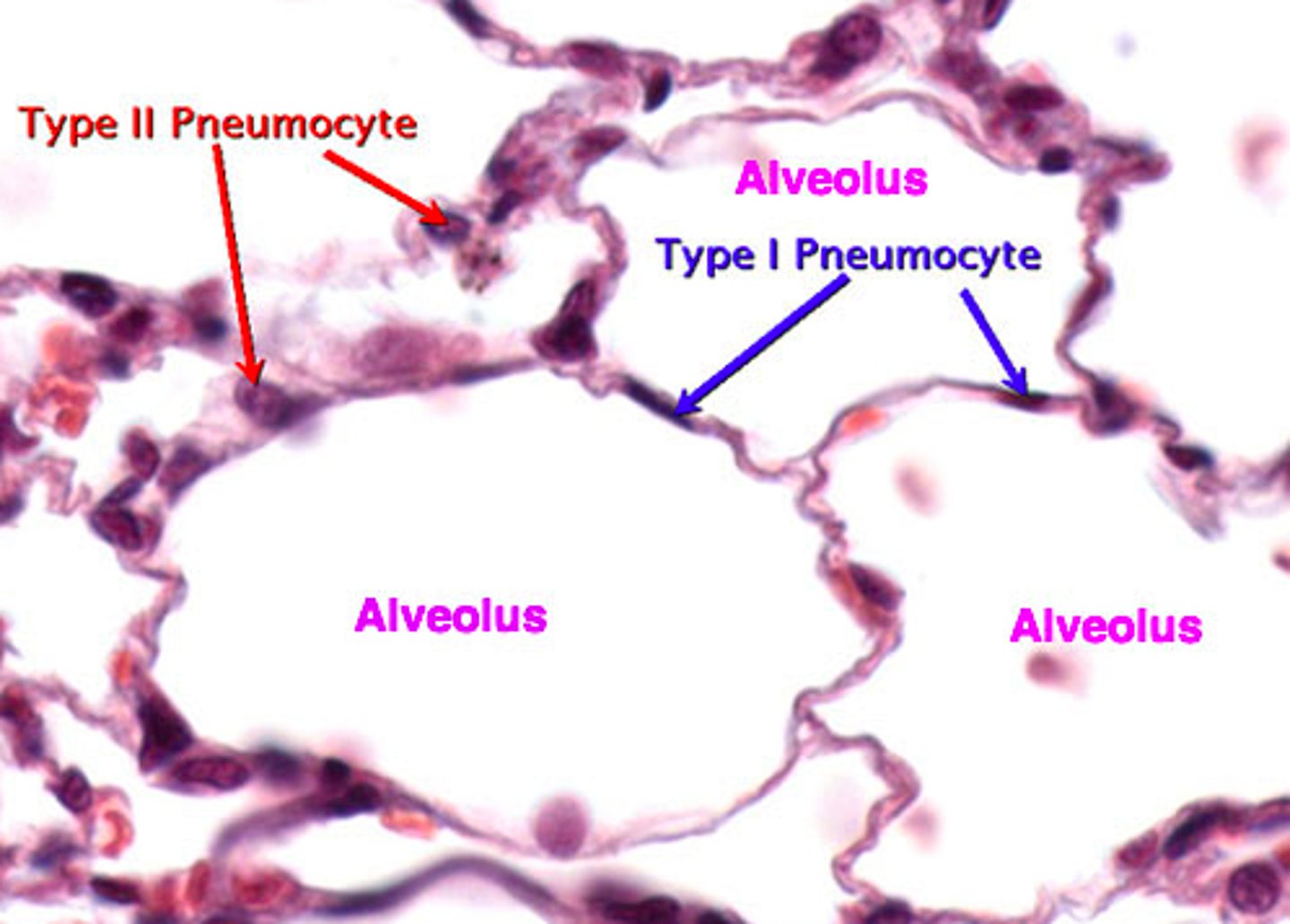 <p>No possible better photo, this is a type 1 pneumocyte (Notice it's flat shape)</p>