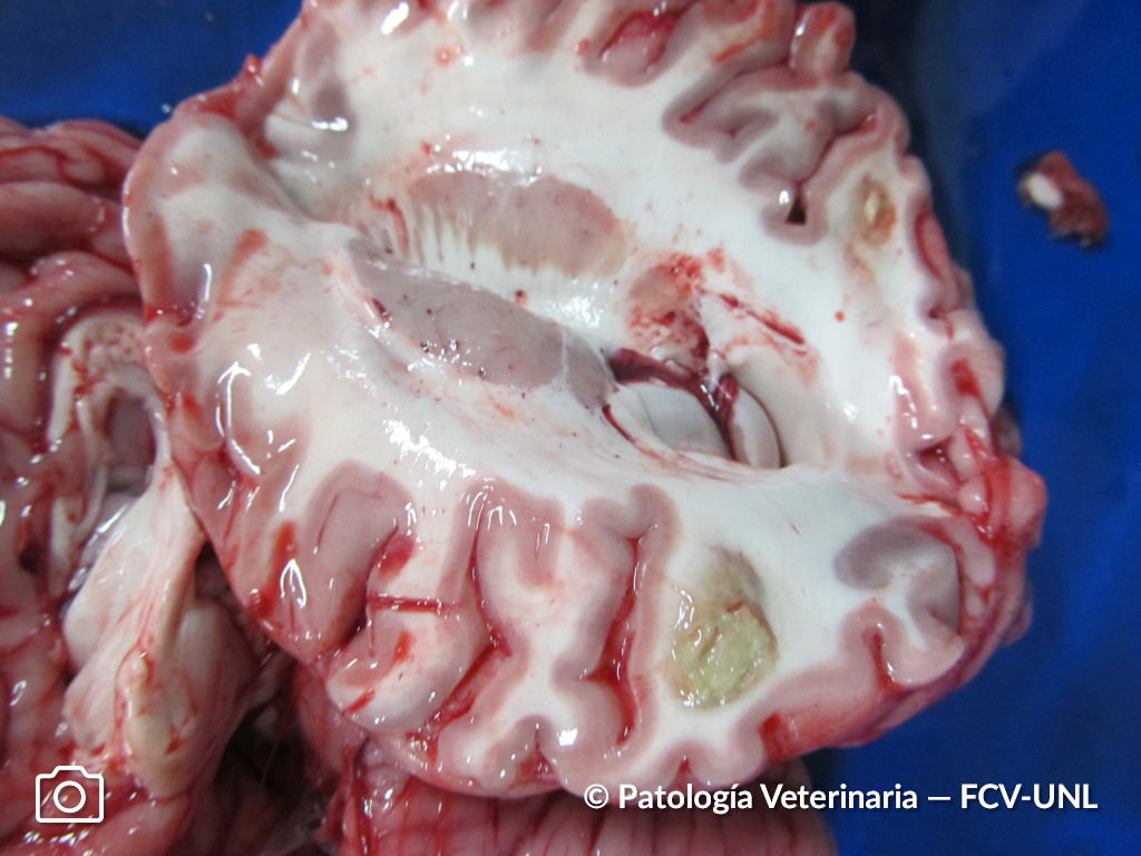 <p>Digestión completa de las células muertas.</p>