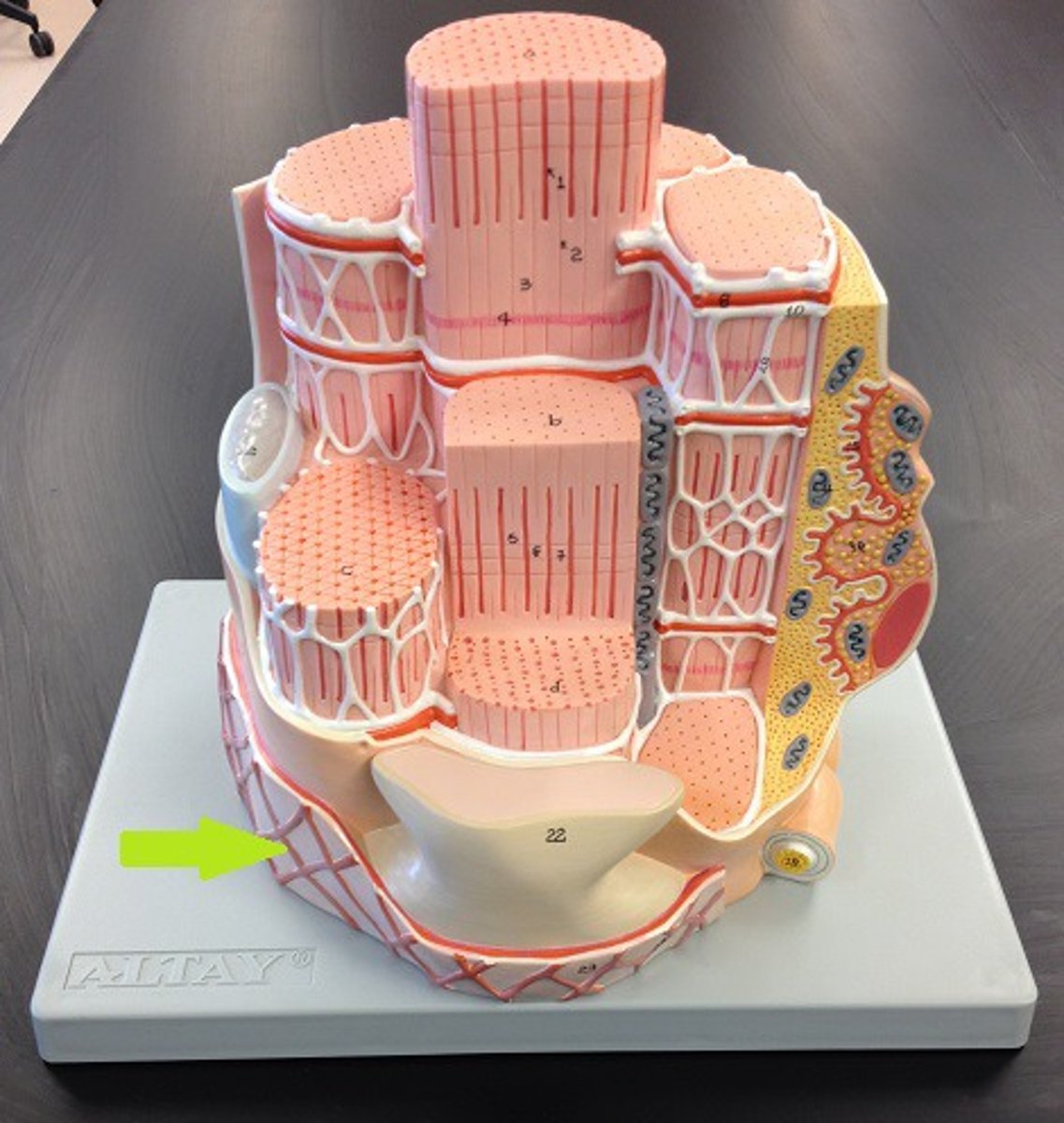 <p>connective tissue layer -- Surrounds individual muscle fibers</p>