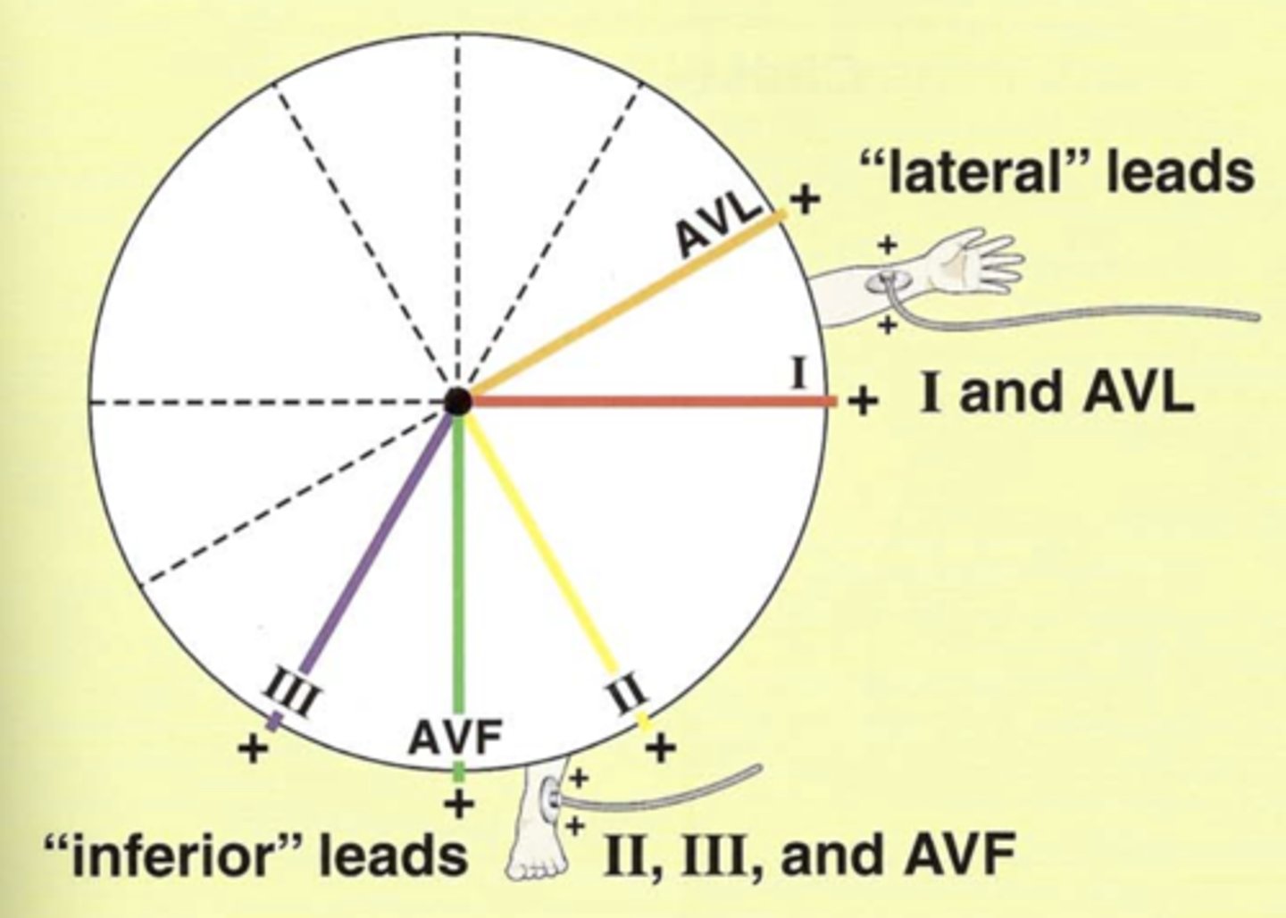 <p>The six limb leads consist of the three bipolar leads, I, II, III, and three augmented leads, aVR, aVL, aVF.</p>