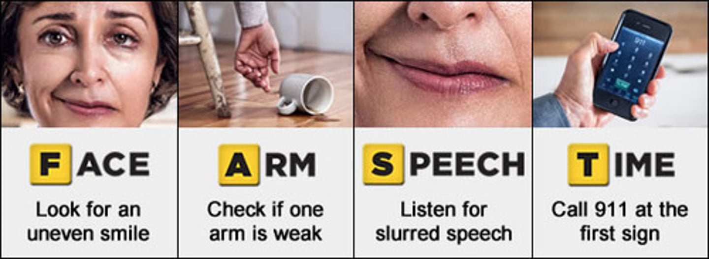 <p>• Transport immediately to hospital with advanced stroke care</p><p>• FAST: Facial drop, Arm weakness, Speech difficulty, Time to call 9-1-1</p>