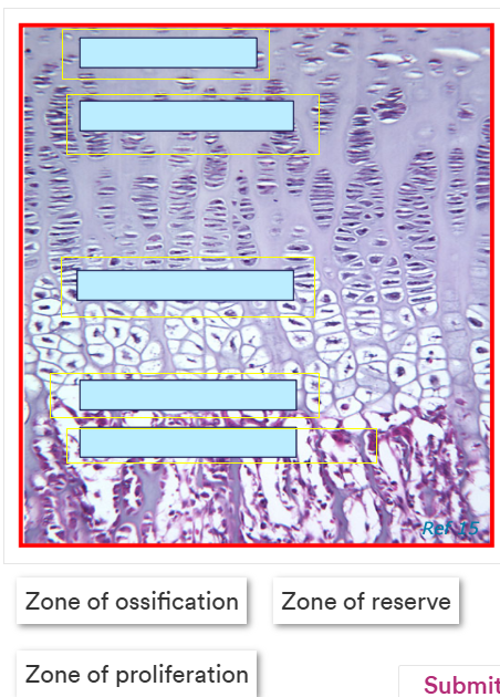 <p>Label this image correctly.</p><p>Terms - zone of degeneration, zone of hypertrophy, zone of reserve, zone of proliferation and zone of ossification</p>