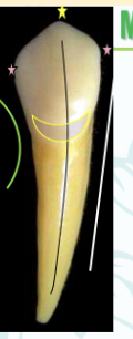 <p><mark data-color="#ffc1ec" style="background-color: #ffc1ec; color: inherit">mandibular canines #22 and #27; cusp slope</mark></p>