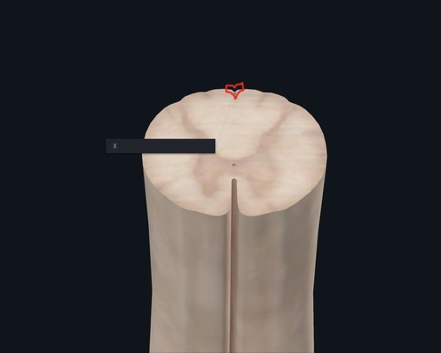 <p>Name the landmark indicated by the X and outlined red.</p>