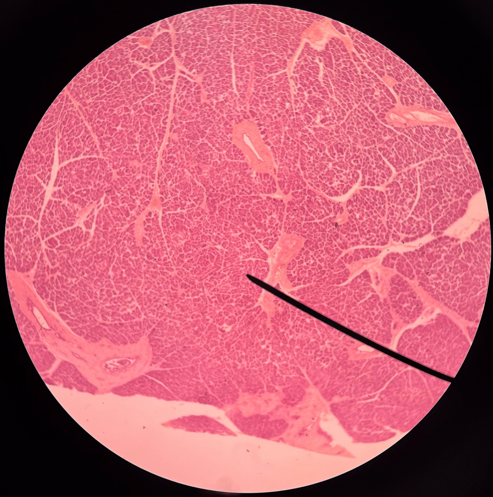 • Slide histology of the pancreas.

• Dark-staining cells that produce digestive enzymes.