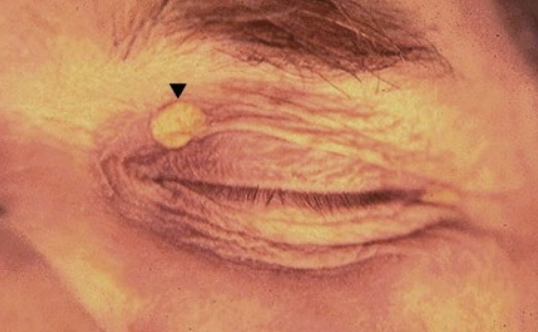 term image