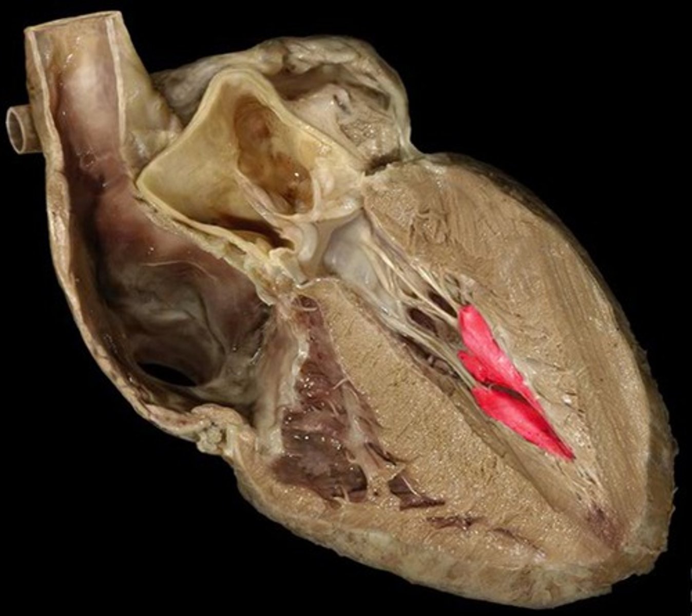 knowt flashcard image