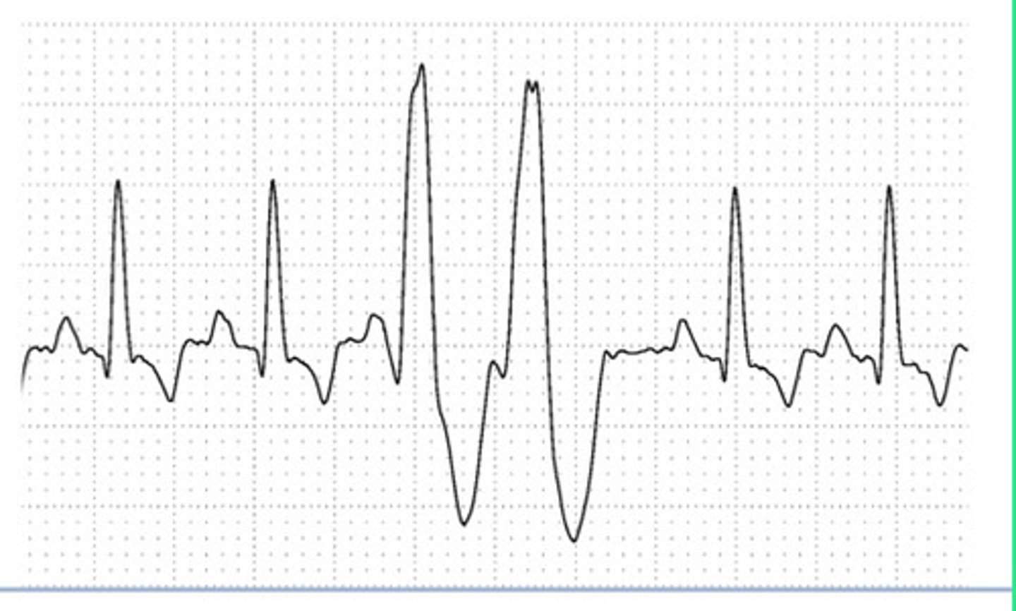 <p>What is the origin of this ECG?</p>