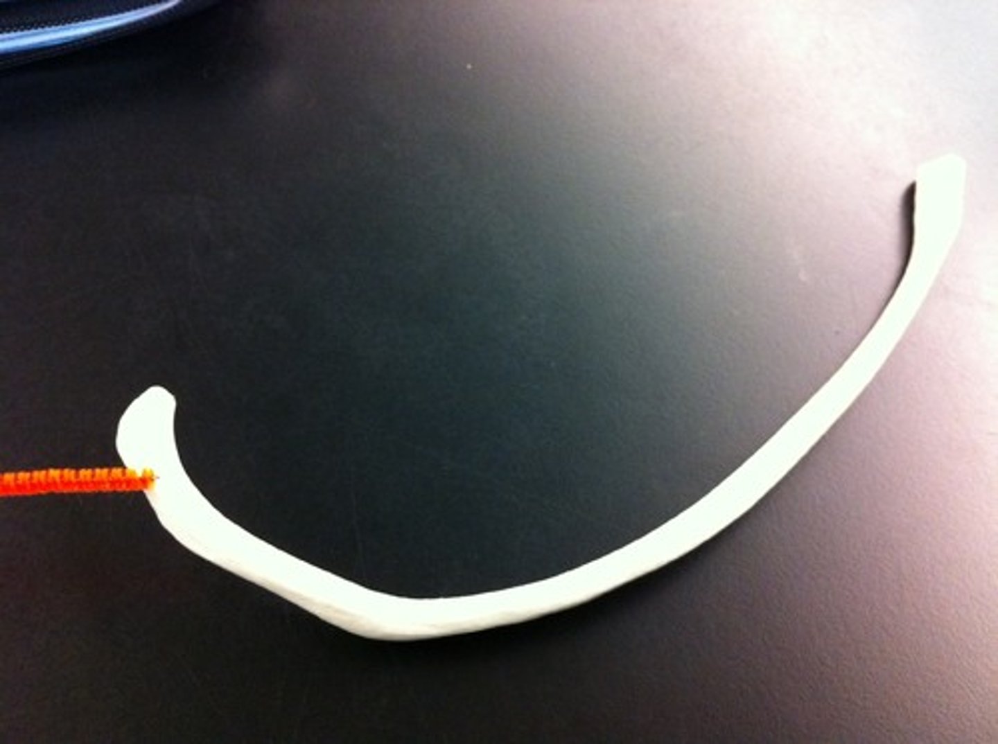 <p>Rib - between head and tubercle</p>