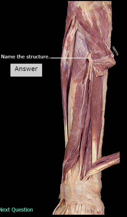 <p>What nerve is this</p>