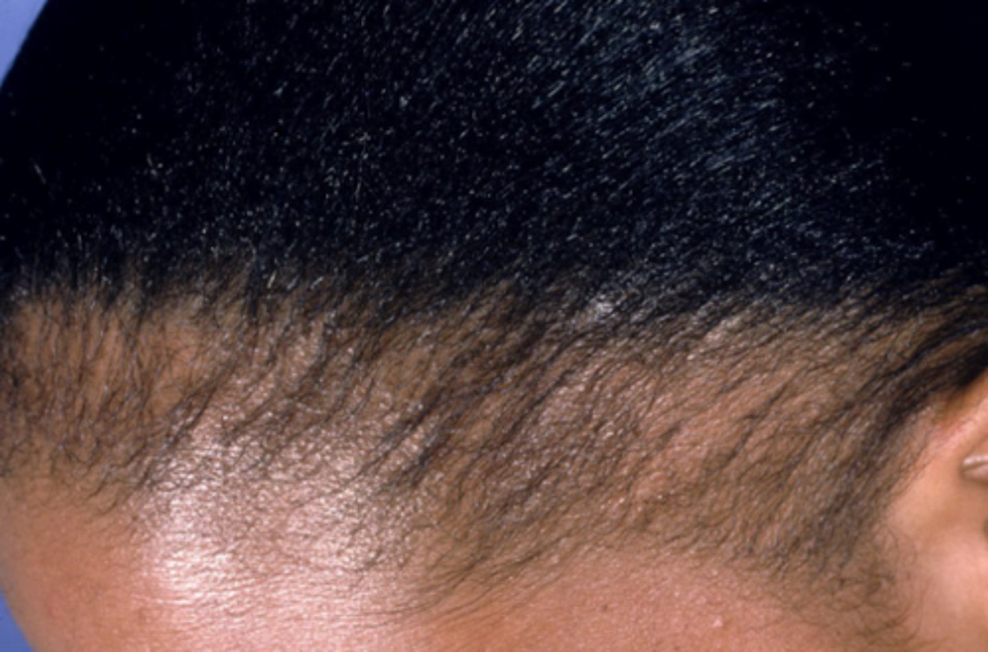 <p>What is the diagnosis?</p>