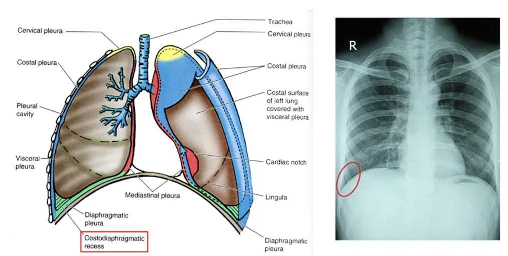<ul><li><p>space in lowest part of the thoracic cavity where the costal and diaphragmatic pleurae join</p></li><li><p><strong>potential space into which the lung can expand </strong>during full inspiration and where <strong>excess fluids may accumulate</strong> when the person is standing upright</p></li></ul>