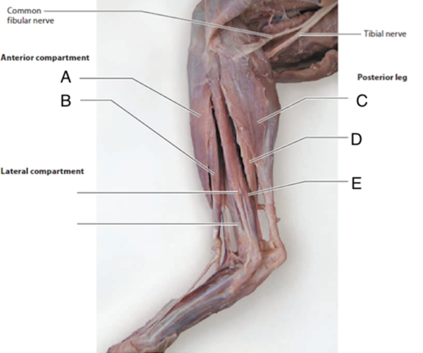 <p>What is the muscle indicated by letter C? What is an attachment point and function?</p>