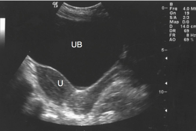 What is the echogenicity of the bladder?