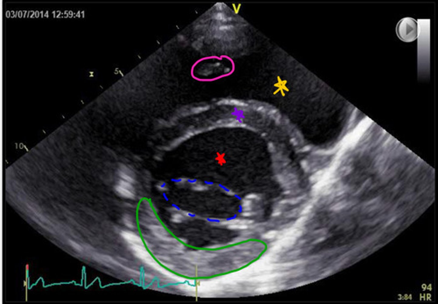 <p>ID parts of heart</p>